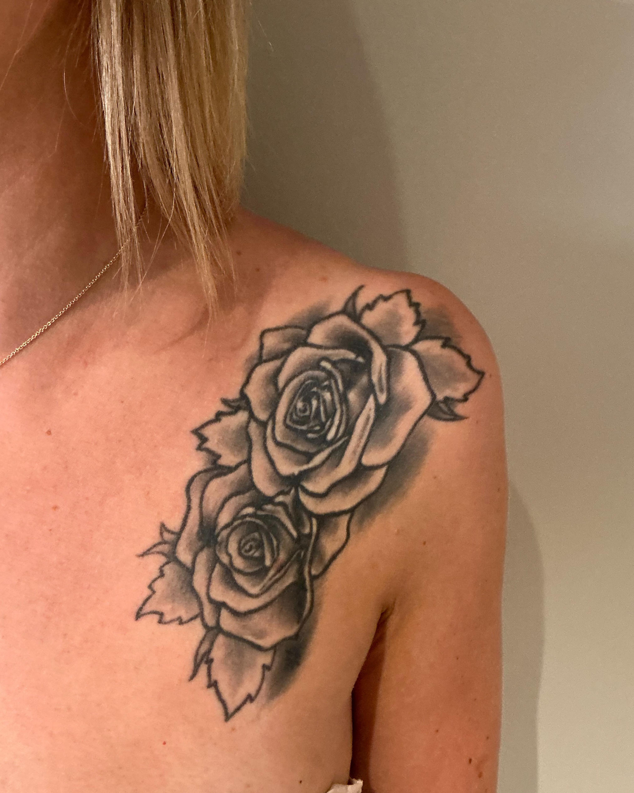 tattooentfernung